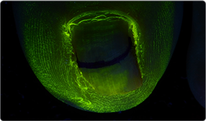 UV light after application 1