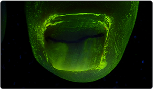 UV light after application 2