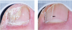 See before and after results with JUBLIA